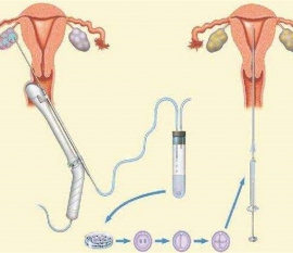 35岁女性备孕请做好以下检查，“健康成都代生宝宝”跑不远